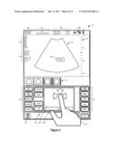 SYSTEMS AND METHODS FOR INTERFACING WITH AN ULTRASOUND SYSTEM diagram and image