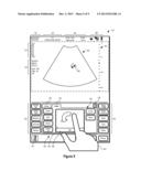 SYSTEMS AND METHODS FOR INTERFACING WITH AN ULTRASOUND SYSTEM diagram and image