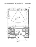 SYSTEMS AND METHODS FOR INTERFACING WITH AN ULTRASOUND SYSTEM diagram and image