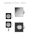 SYSTEMS AND METHODS FOR IMAGING THE FUNDUS OF THE EYE diagram and image