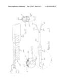 EXTENDED TIP LASER AND ILLUMINATION PROBE FOR RETINA SURGERY diagram and image