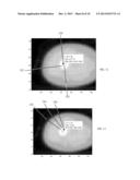 METHODS AND SYSTEMS FOR PERFORMING ATTENUATION CORRECTION diagram and image