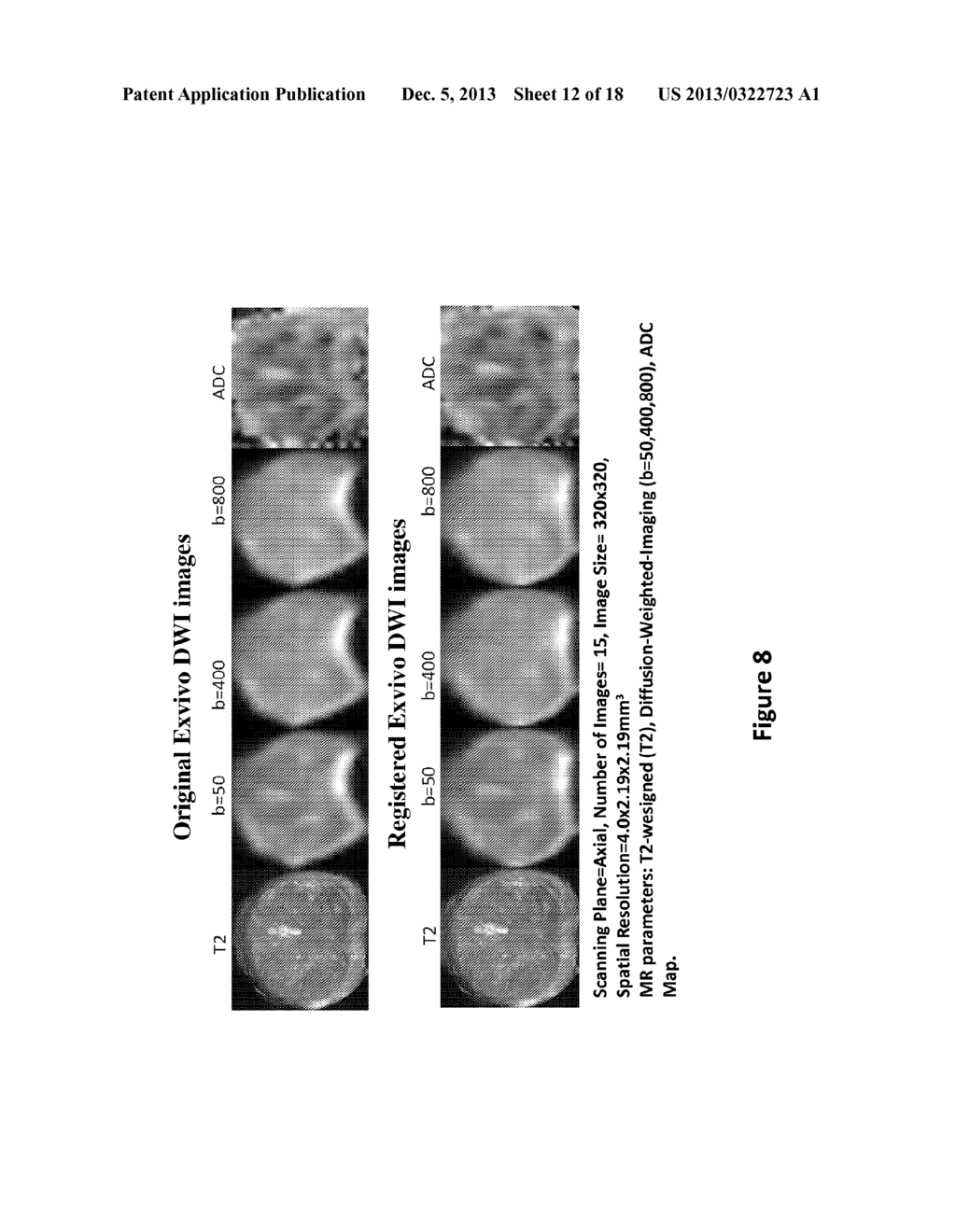 METHODS AND SYSTEMS FOR REGISTRATION OF RADIOLOGICAL IMAGES - diagram, schematic, and image 13