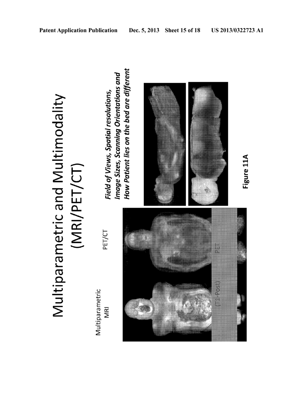 METHODS AND SYSTEMS FOR REGISTRATION OF RADIOLOGICAL IMAGES - diagram, schematic, and image 16