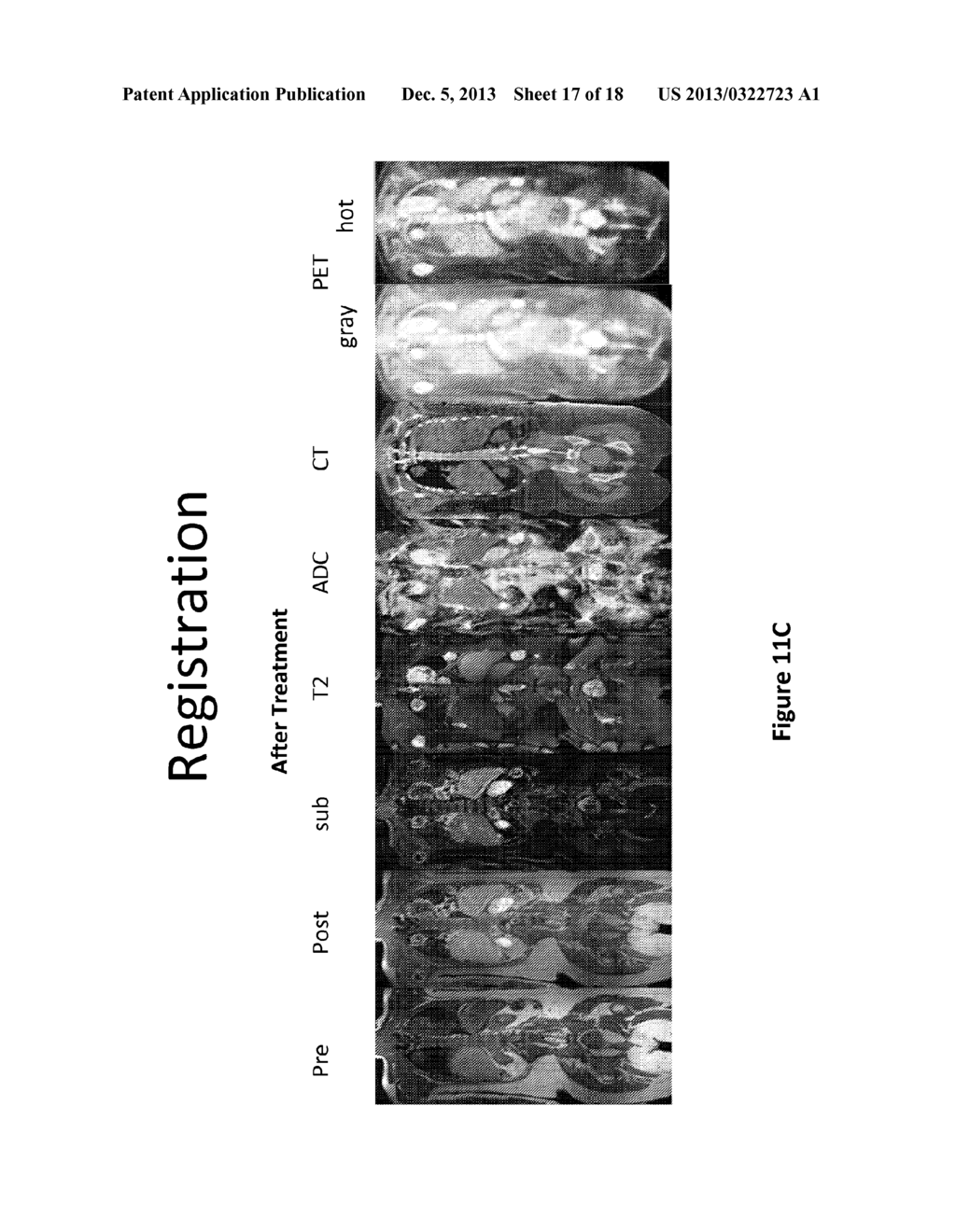 METHODS AND SYSTEMS FOR REGISTRATION OF RADIOLOGICAL IMAGES - diagram, schematic, and image 18