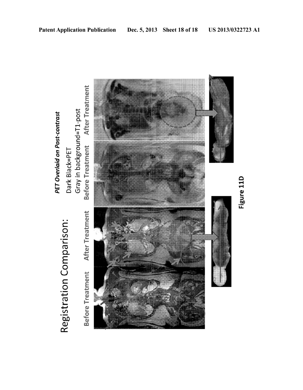 METHODS AND SYSTEMS FOR REGISTRATION OF RADIOLOGICAL IMAGES - diagram, schematic, and image 19