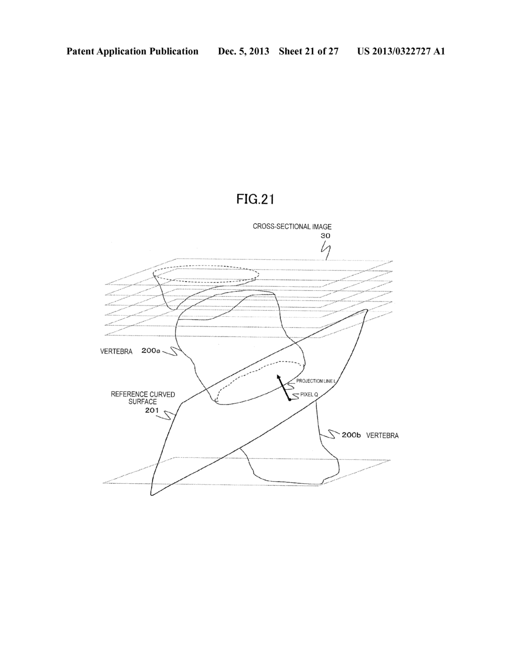 MEDICAL IMAGE PROCESSING DEVICE AND MEDICAL IMAGE PROCESSING METHOD - diagram, schematic, and image 22