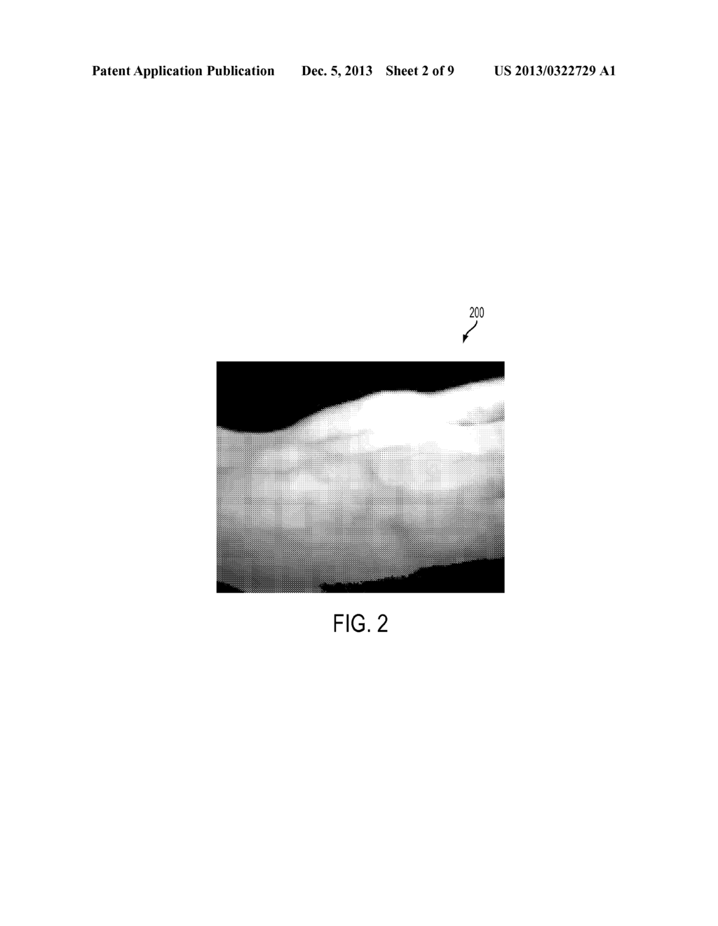 PROCESSING A VIDEO FOR VASCULAR PATTERN DETECTION AND CARDIAC FUNCTION     ANALYSIS - diagram, schematic, and image 03