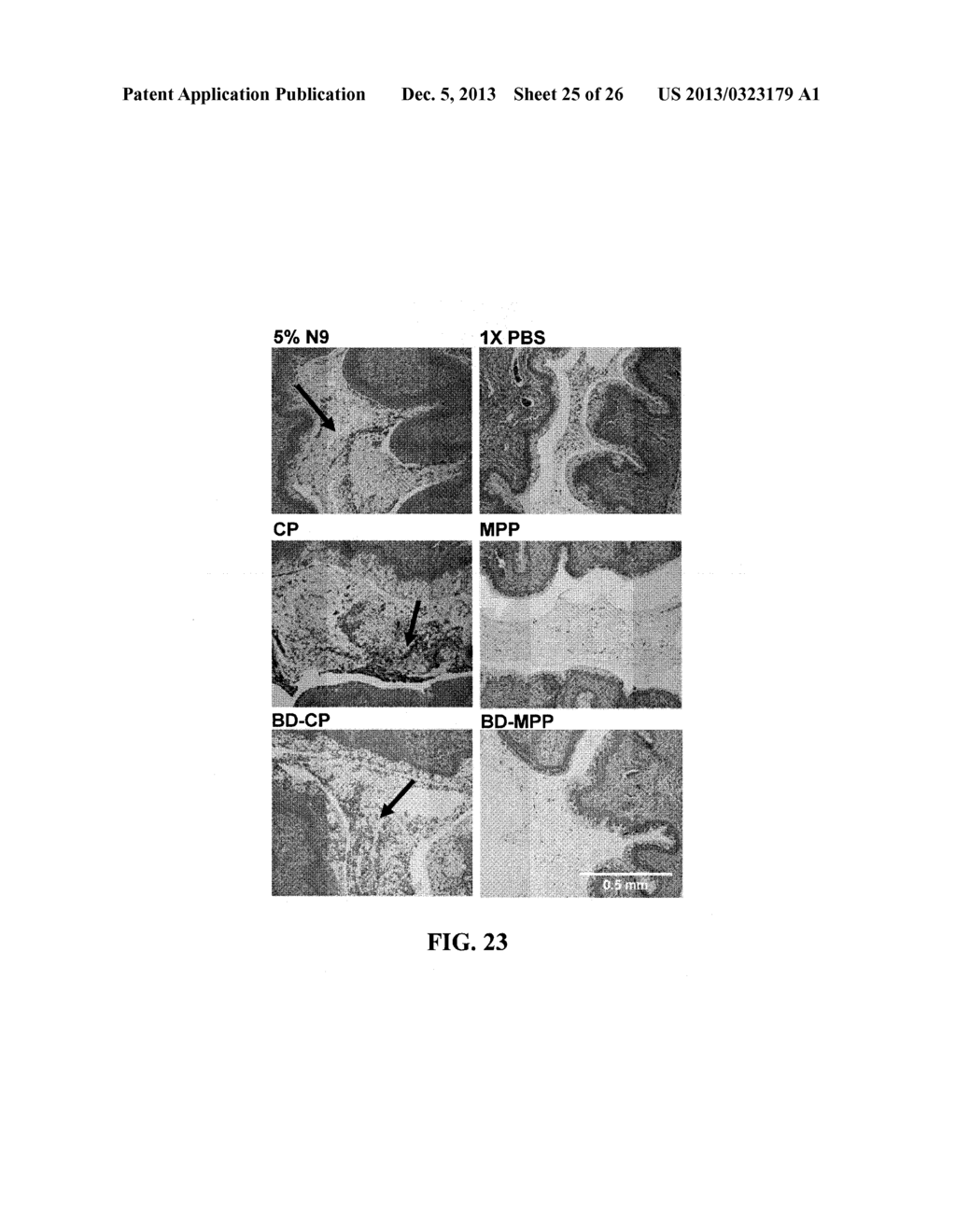 NANOCRYSTALS, COMPOSITIONS, AND METHODS THAT AID PARTICLE TRANSPORT IN     MUCUS - diagram, schematic, and image 26