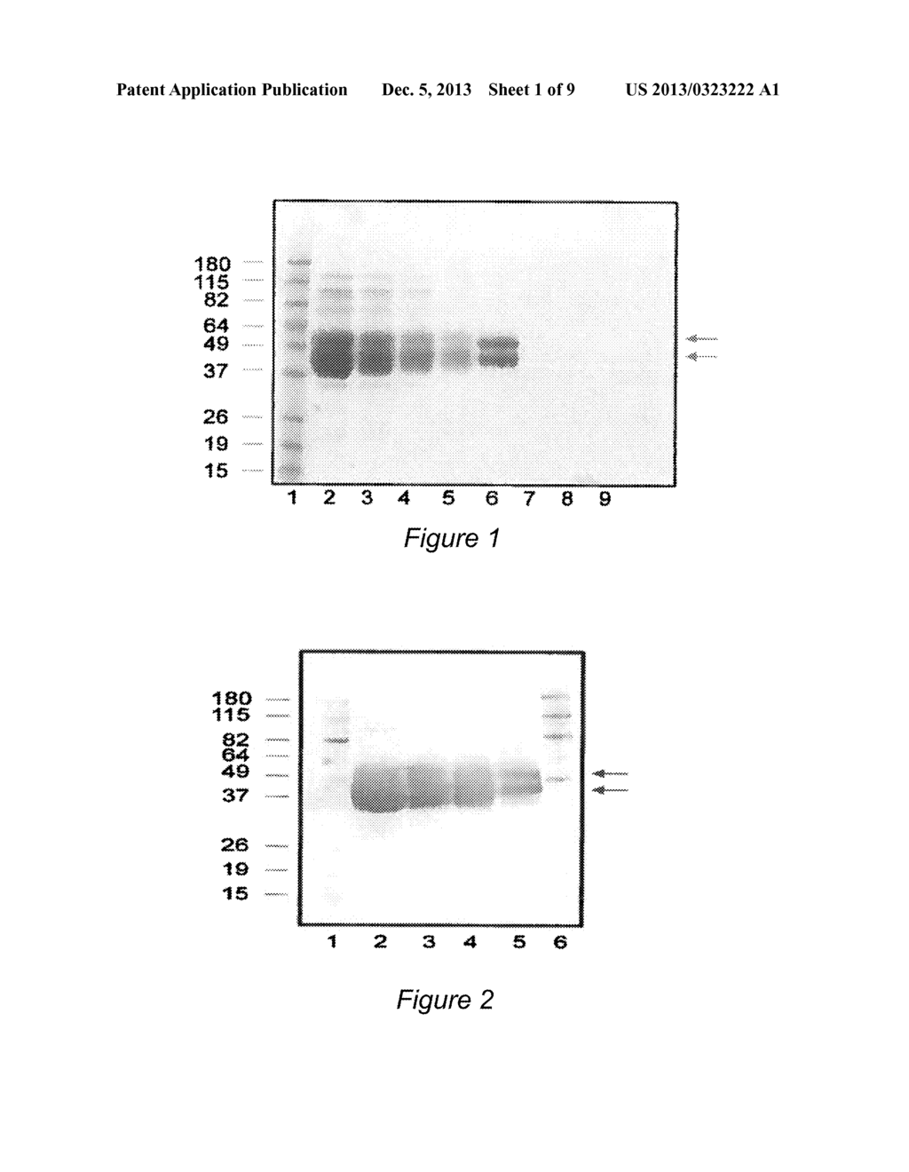 HUMAN TISSUE KALLIKREIN 1 GLYCOSYLATION ISOFORMS - diagram, schematic, and image 02