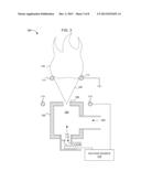 BURNER SYSTEM WITH ANTI-FLASHBACK ELECTRODE diagram and image