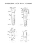 DENTAL RESTORATIVE SYSTEM AND COMPONENTS diagram and image