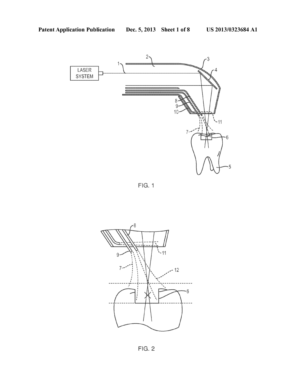 APPARATUS AND METHOD FOR CONTROLLED FLUID COOLING DURING LASER BASED     DENTAL TREATMENTS - diagram, schematic, and image 02