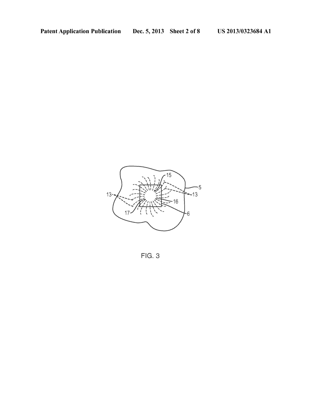 APPARATUS AND METHOD FOR CONTROLLED FLUID COOLING DURING LASER BASED     DENTAL TREATMENTS - diagram, schematic, and image 03