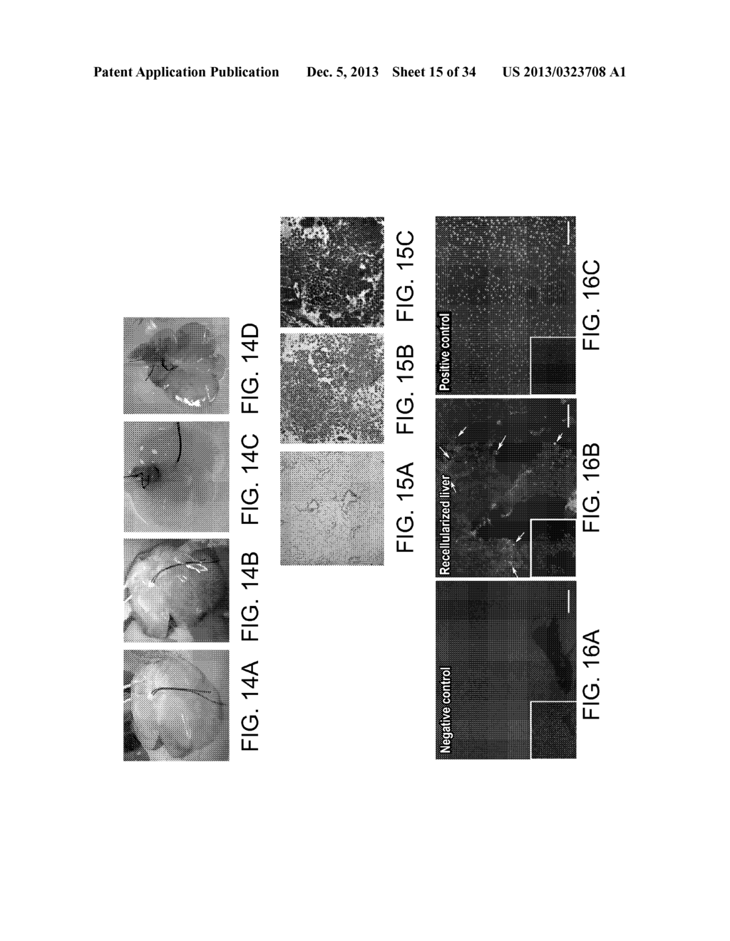 ISOLATED ADULT CELLS, ARTIFICIAL ORGANS, REHABILITATED ORGANS, RESEARCH     TOOLS, ORGAN ENCASEMENTS, ORGAN PERFUSION SYSTEMS, AND METHODS FOR     PREPARING AND UTILIZING THE SAME - diagram, schematic, and image 16