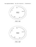 RECOMBINATIONAL CLONING USING ENGINEERED RECOMBINATION SITES diagram and image