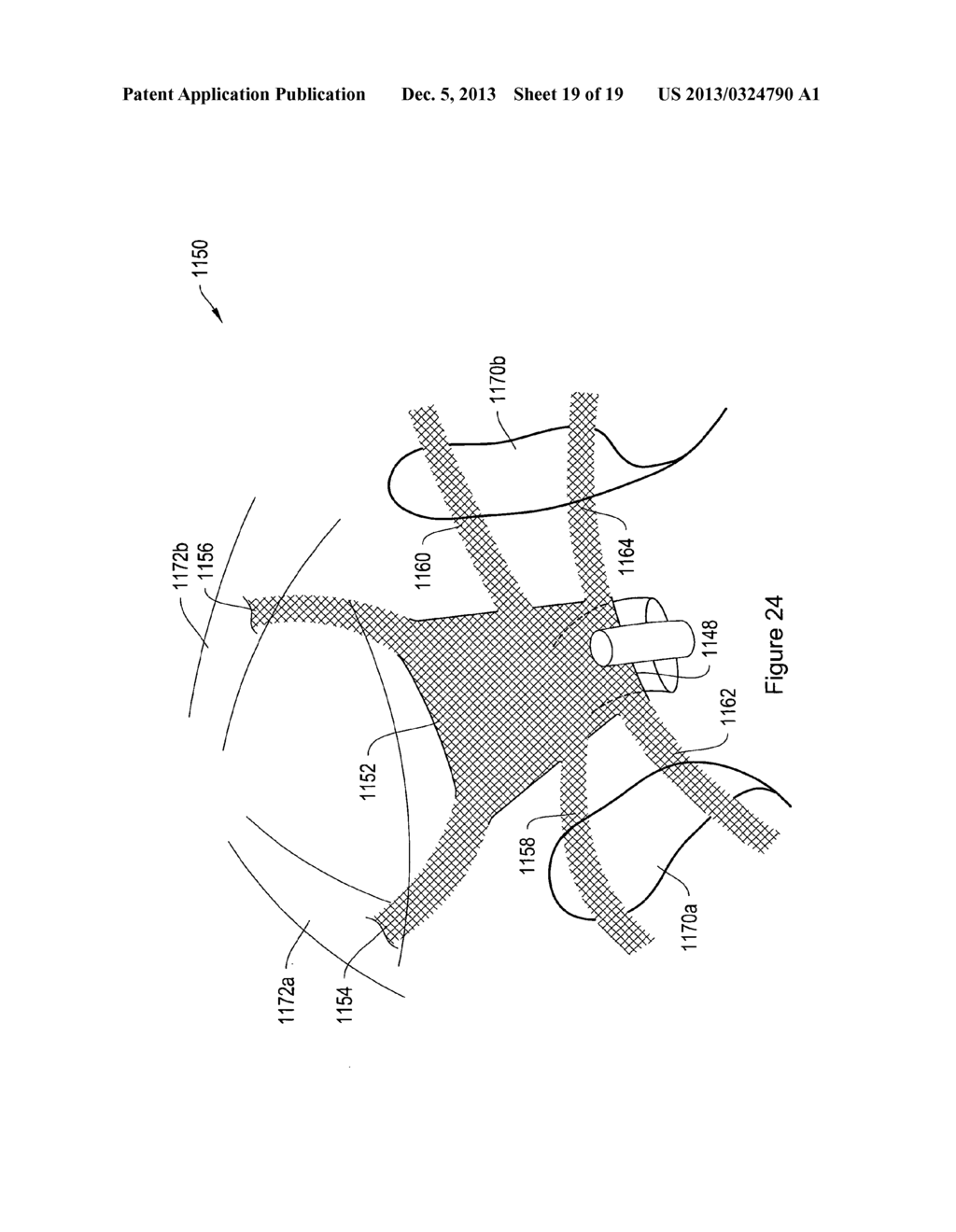 PELVIC FLOOR REPAIR SYSTEM - diagram, schematic, and image 20