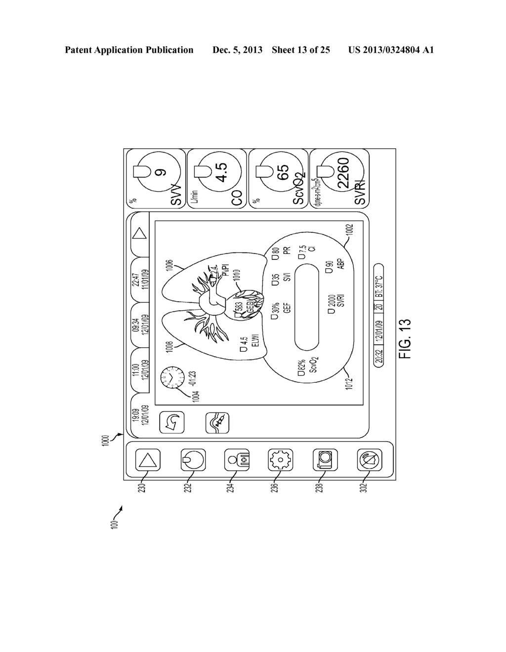 SYSTEMS AND METHODS FOR MONITORING AND DISPLAYING A PATIENT'S STATUS - diagram, schematic, and image 14