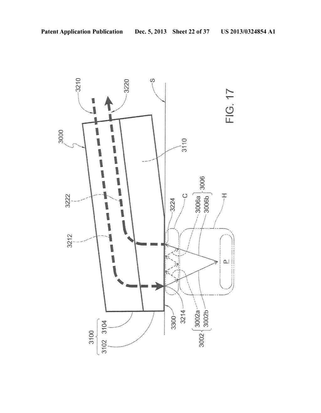 Method for Locating a Transcutaneous Sensor on Skin - diagram, schematic, and image 23