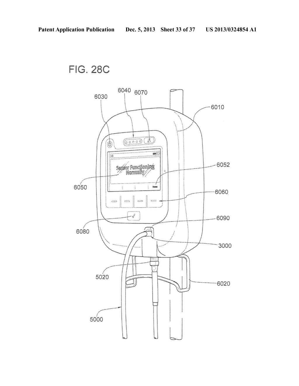 Method for Locating a Transcutaneous Sensor on Skin - diagram, schematic, and image 34