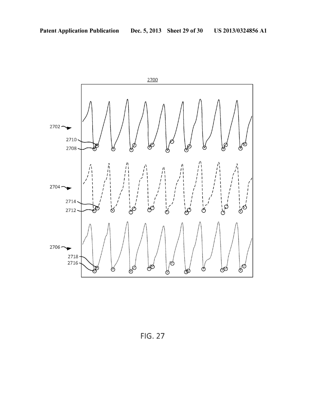 METHODS AND SYSTEMS FOR POWER OPTIMIZATION IN A MEDICAL DEVICE - diagram, schematic, and image 30