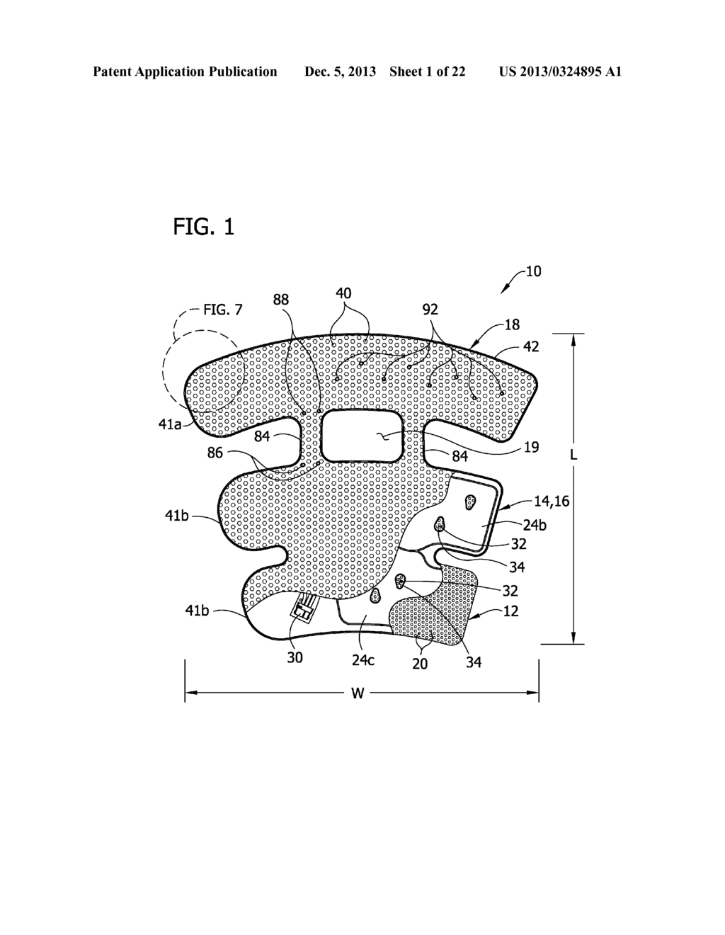 Method of Making Compression Sleeve with Structural Support Features - diagram, schematic, and image 02