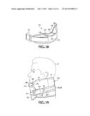 DEVICE AND METHOD FOR STABILIZATION OF A FRACTURED PELVIS OR AN INJURED     NECK diagram and image