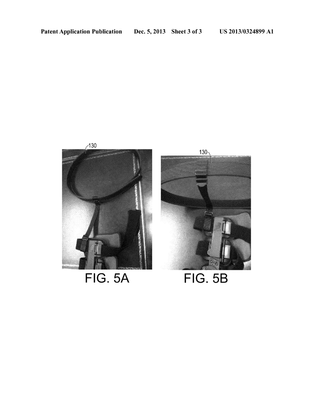 BRACE WITH A SECURING DEVICE - diagram, schematic, and image 04