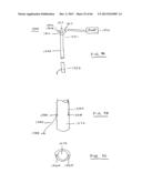 DEVICES AND METHODS FOR GASTROINTESTINAL BYPASS diagram and image