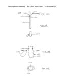 DEVICES AND METHODS FOR GASTROINTESTINAL BYPASS diagram and image