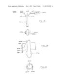 DEVICES AND METHODS FOR GASTROINTESTINAL BYPASS diagram and image