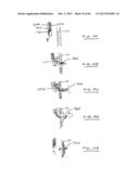 DEVICES AND METHODS FOR GASTROINTESTINAL BYPASS diagram and image