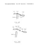 DEVICES AND METHODS FOR GASTROINTESTINAL BYPASS diagram and image