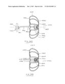 DEVICES AND METHODS FOR GASTROINTESTINAL BYPASS diagram and image