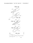 CORPOREAL CATHETERS diagram and image