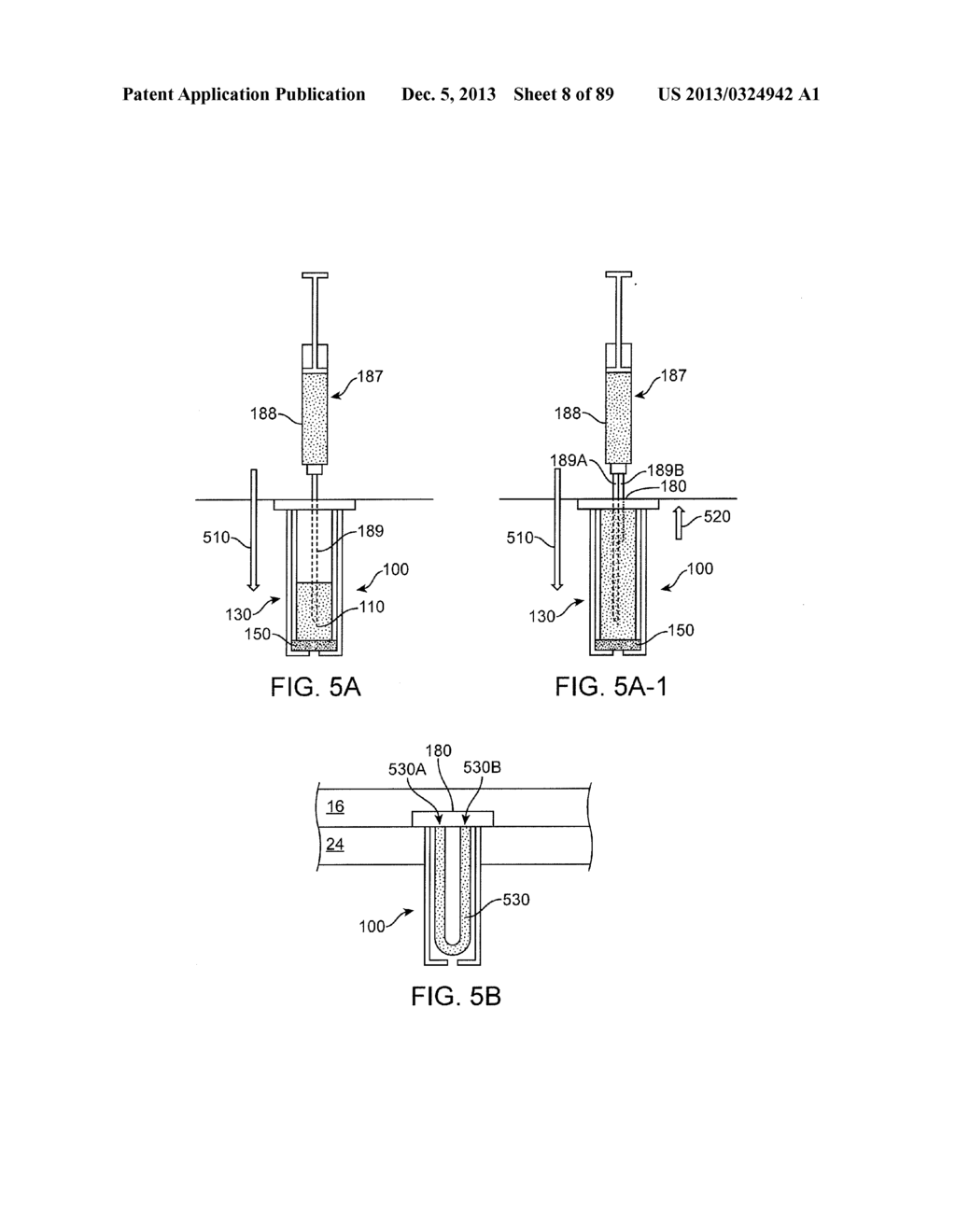 IMPLANTABLE THERAPEUTIC DEVICE - diagram, schematic, and image 09