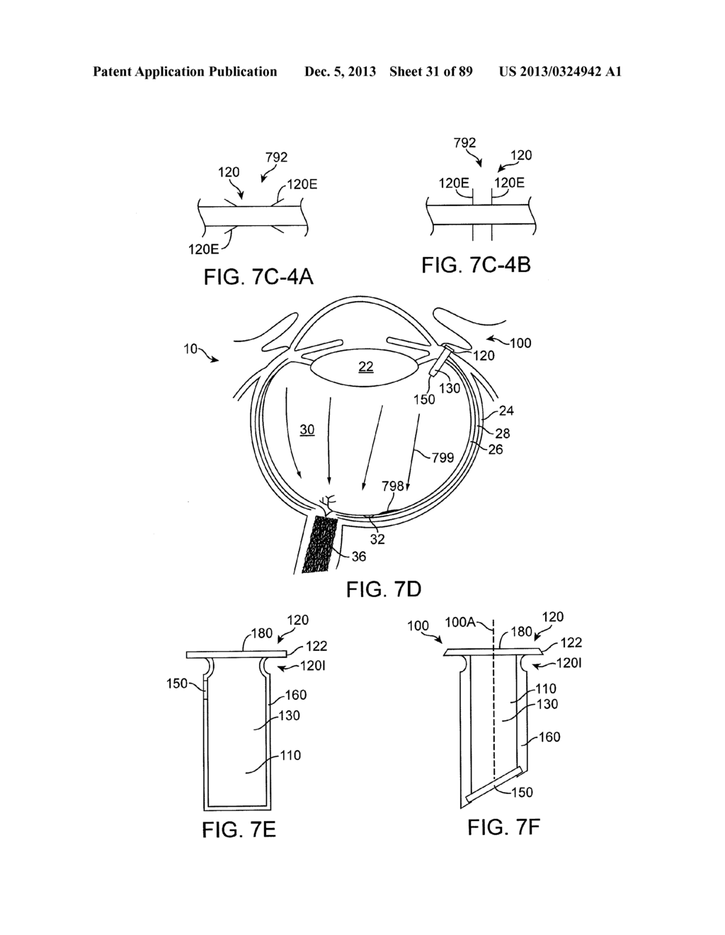 IMPLANTABLE THERAPEUTIC DEVICE - diagram, schematic, and image 32