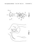 TRANSCUTANEOUS IMPLANT TOOLS, SYSTEMS AND METHODS diagram and image