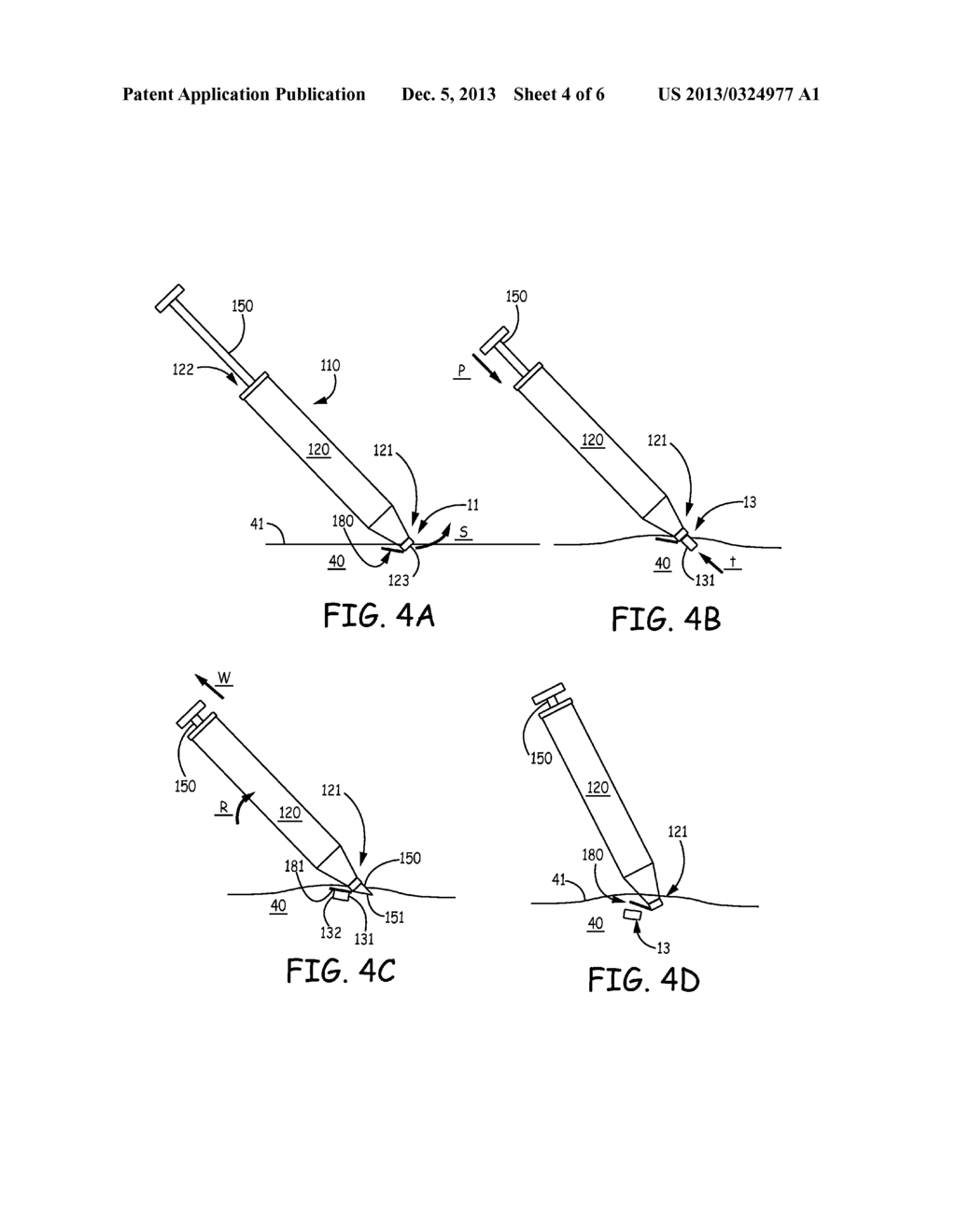 TRANSCUTANEOUS IMPLANT TOOLS, SYSTEMS AND METHODS - diagram, schematic, and image 05