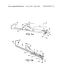 TRANSCUTANEOUS IMPLANT TOOLS, SYSTEMS AND METHODS diagram and image