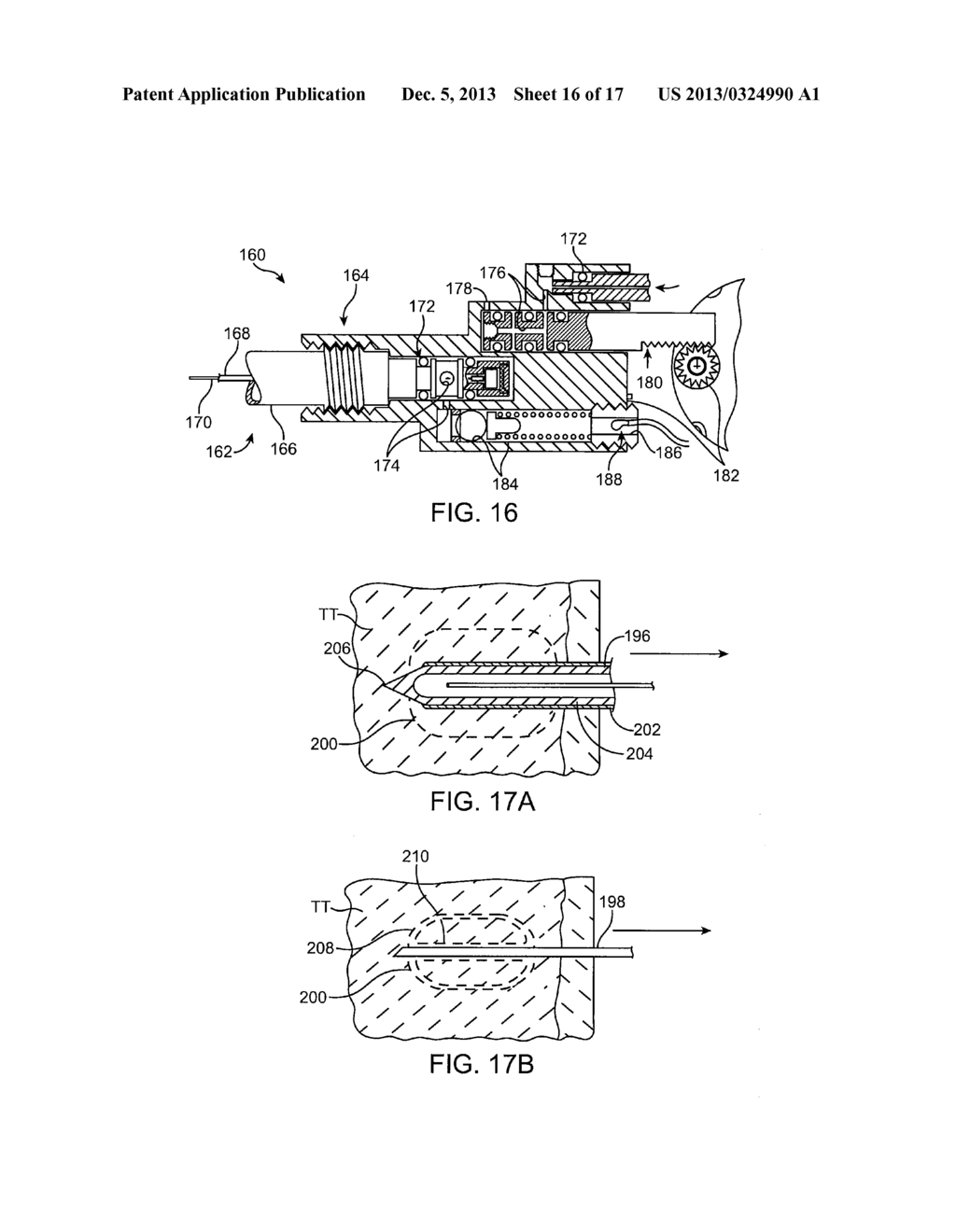 Replaceable and/or Easily Removable Needle Systems for Dermal and     Transdermal Cryogenic Remodeling - diagram, schematic, and image 17