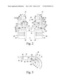 METHOD OF SURGICALLY PREPARING A PATIENT S FEMUR diagram and image