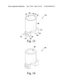 METHOD OF SURGICALLY PREPARING A PATIENT S FEMUR diagram and image