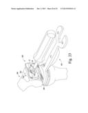 METHOD OF SURGICALLY PREPARING A PATIENT S FEMUR diagram and image