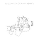 METHOD OF SURGICALLY PREPARING A PATIENT S FEMUR diagram and image