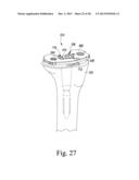 TIBIAL ORTHOPAEDIC SURGICAL INSTRUMENTS AND METHOD OF USING SAME diagram and image