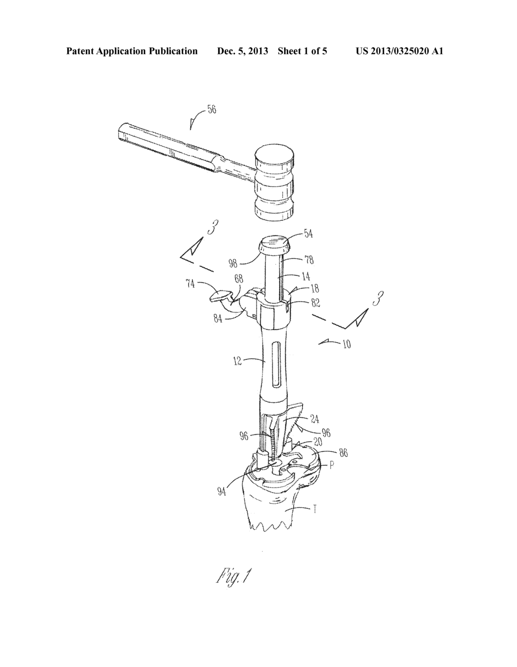 SURGICAL INSTRUMENT FOR IMPACTING AND EXTRACTING A CUTTING INSTRUMENT - diagram, schematic, and image 02