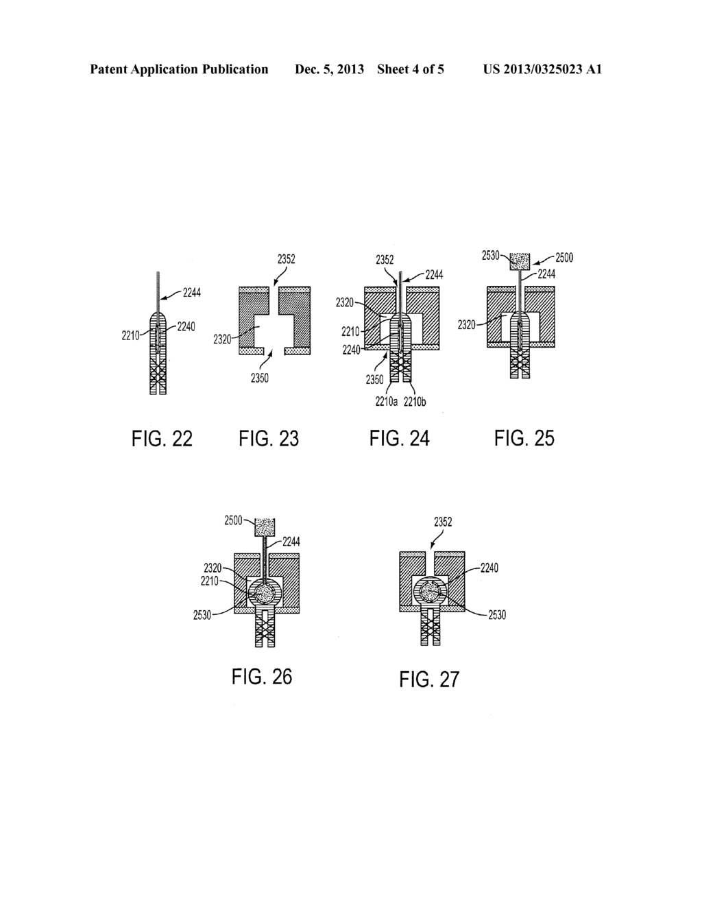 Methods and Devices for Anchoring a Graft to Bone - diagram, schematic, and image 05