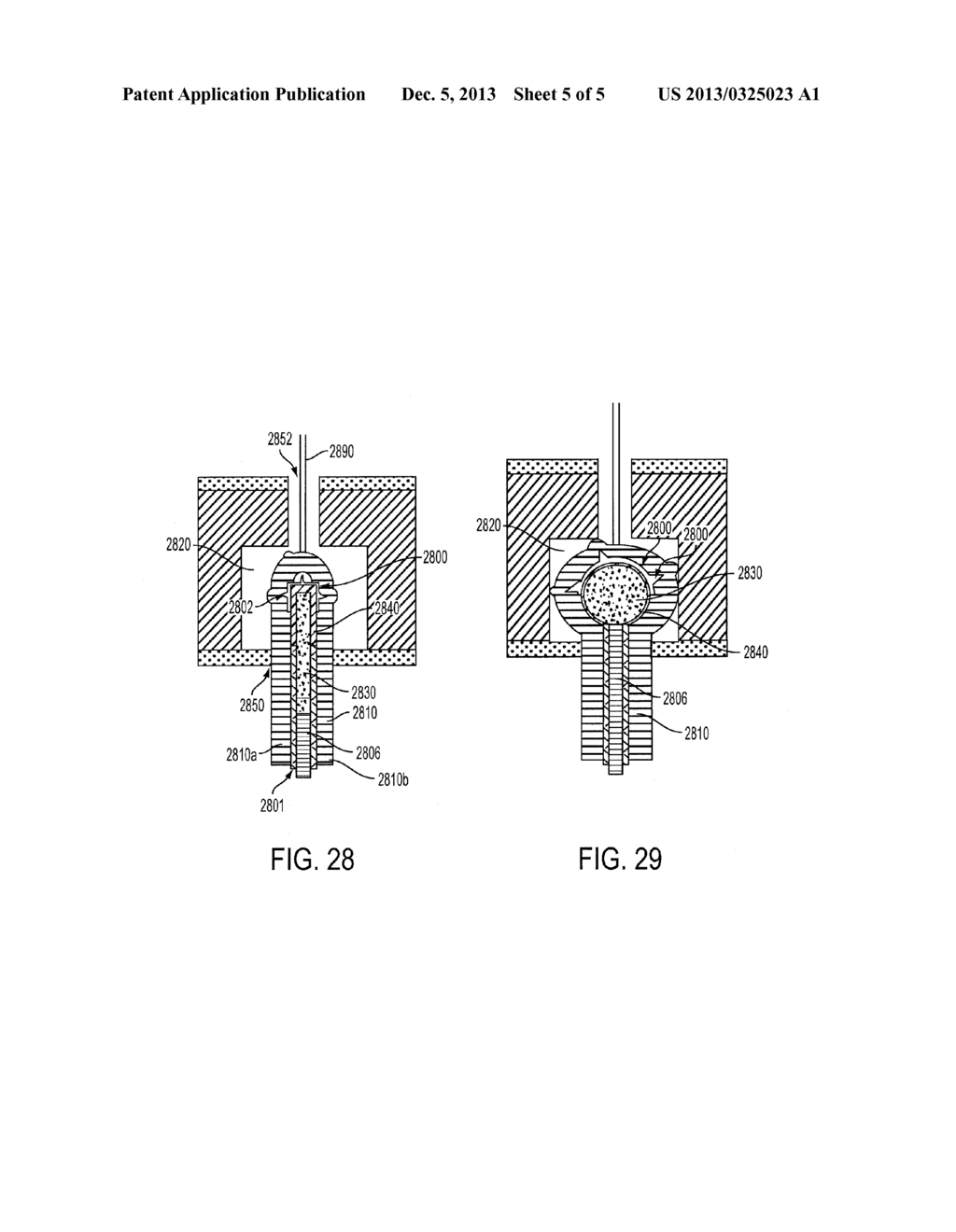 Methods and Devices for Anchoring a Graft to Bone - diagram, schematic, and image 06