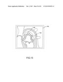 Robotic surgical system and method for automated therapy delivery diagram and image